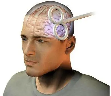 tms neurologista sp - março 2026