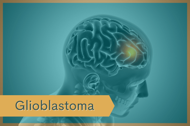 glioblastoma