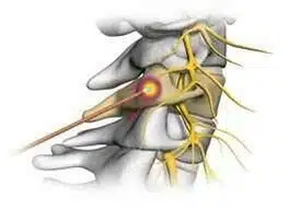 Dores no Pescoço 1 img 2139 - março 2026
