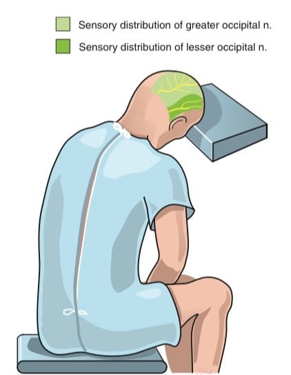 neuralgia do occipital