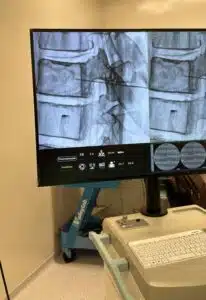 Neuralgia Pós Herpes Zoster 2 herpes zoster